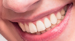 Branche Dental